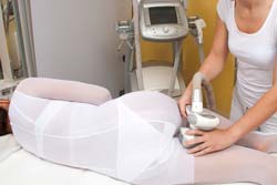 Mesotherapy Cellulite Treatment Cost | Kill Cellulite